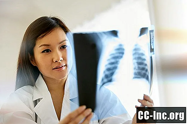 천식 검사 및 진단에서 흉부 X- 레이의 역할