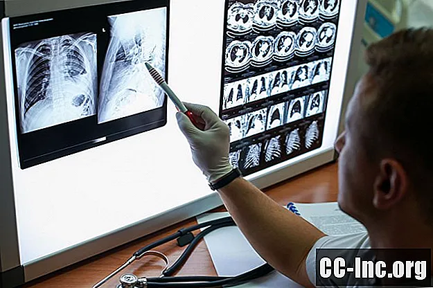 Рентгеново изследване на гръдния кош и КТ за COVID-19