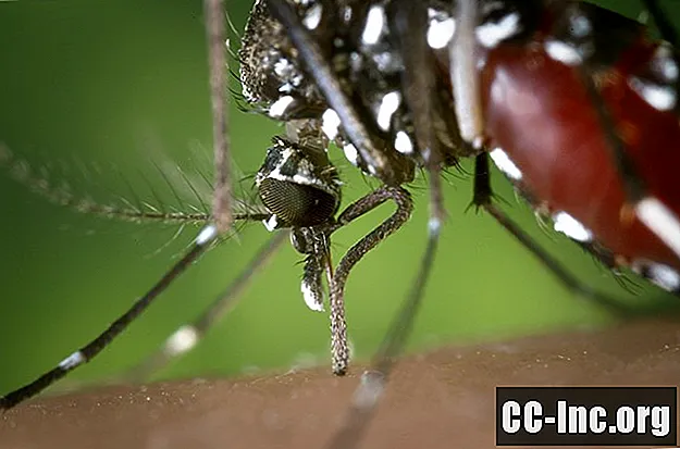 Sintomi e trattamento della Chikungunya
