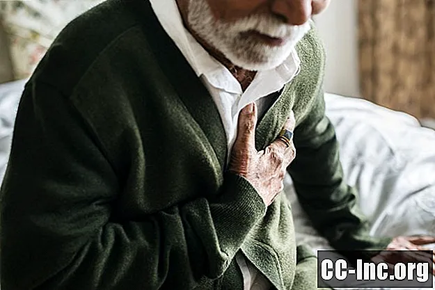 Akciğer Kanseri Cerrahisi Sonrası Kronik Ağrı Sendromları