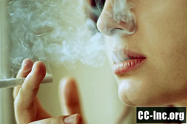 Cigarečių rūkymas ir fibromialgija