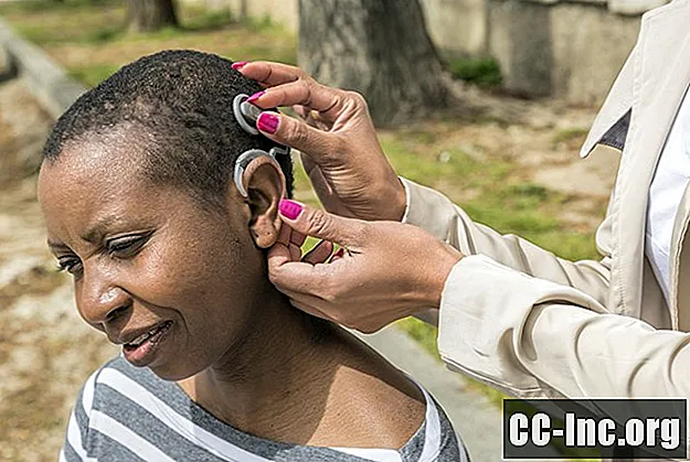 Kohleāro implantu ķirurģija nedzirdīgajiem un vājdzirdīgajiem