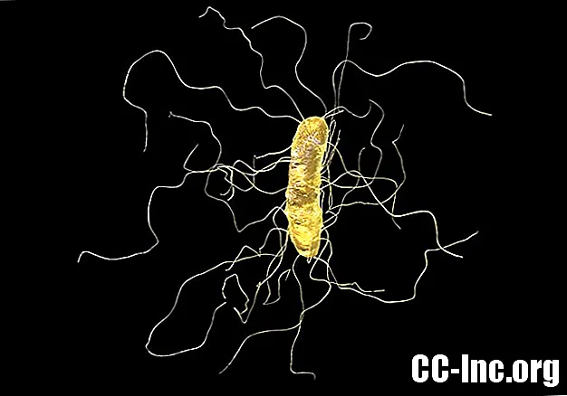 Kolitis, ki ga povzroča Clostridium difficile (C. diff)