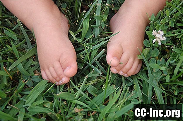 Dažnos vaikų pėdų problemos