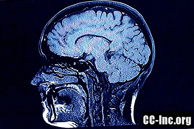 השוואת יכולות אבחון של CT ו- MRI