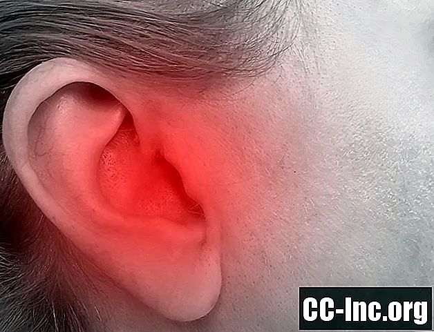 מצבים הגורמים לכאבי אוזניים