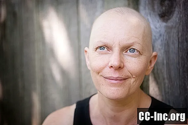 Selviytyminen hiustenlähtöön kemoterapian aikana
