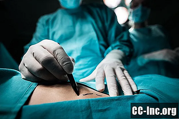 Korrigerende kirurgi etter dårlig plastisk kirurgi - Medisin