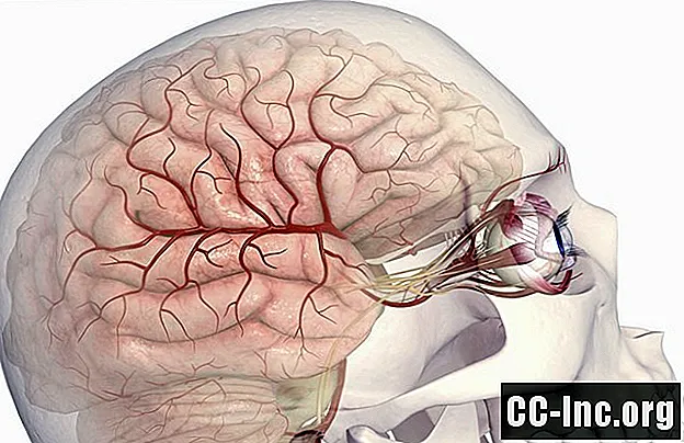 Oštećenje lobanjskog živca od traume glave