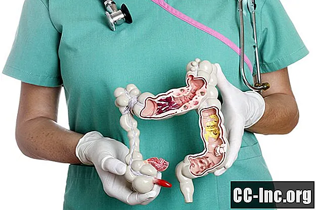 Crohn's colitis in de dikke darm