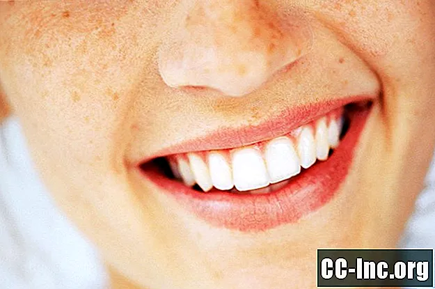 Vloge in motnje zobnih zob