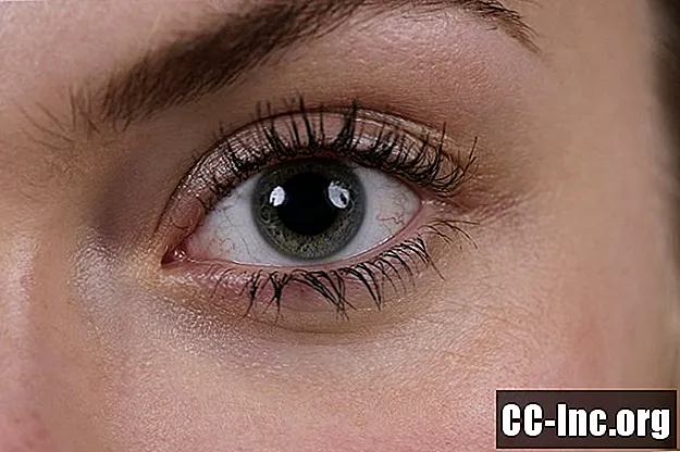 Cycloplegisch gebruik van oogdruppels