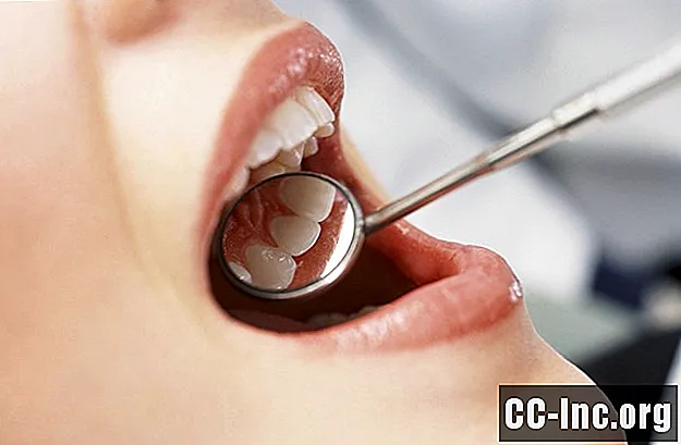 Os problemas dentários mais comuns