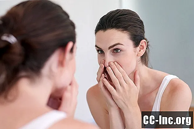 Différents types d'acné et comment il se forme