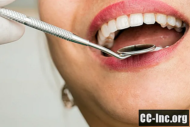 Diferentes tipos de obturações dentárias