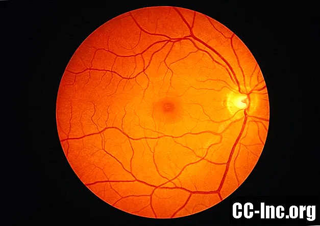 Imagem digital da retina