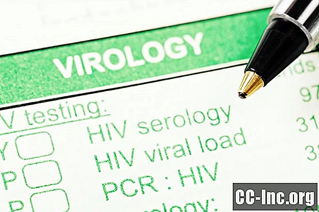 Разграничаване между нови ХИВ инфекции и стари
