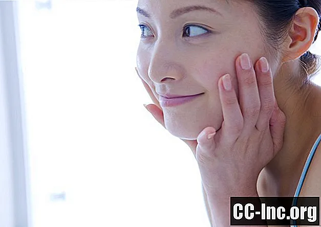 I farmaci per l'acne come l'Accutane causano l'IBD?