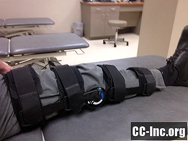 Trebam li nositi aparatić za koljena nakon ACL operacije?