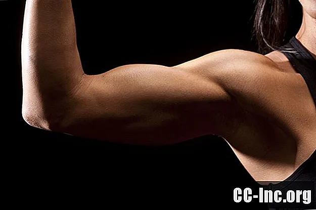 Você precisa de uma cirurgia de tenodese do bíceps?