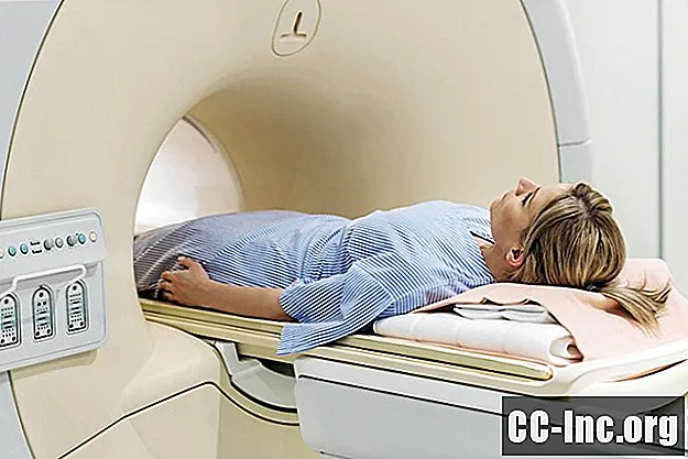 Ali potrebujete magnetno resonanco ali rentgen pred začetkom fizikalne terapije?