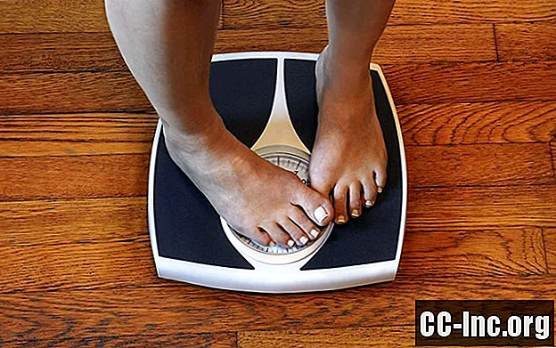 Gör fetma värre fibromyalgi?