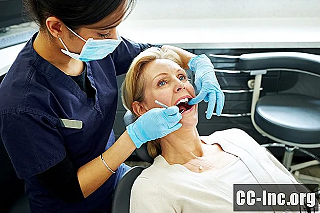هل يؤثر التهاب المفاصل الروماتويدي على الأسنان؟