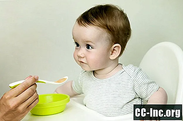 Vai jūsu mazulim ir pārtikas alerģija?