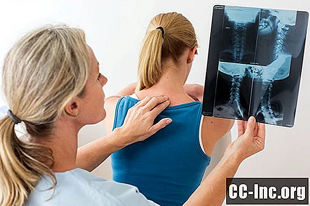האם הפניה למנתח עמוד שדרה פירושה ניתוח?