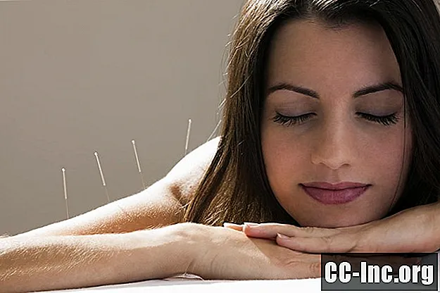 Făcând acupunctură cu fibromialgie și ME / CFS