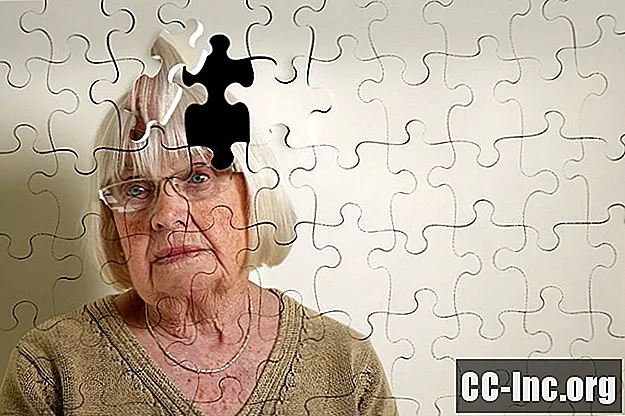 Помирання від деменції із симптомами на пізніх стадіях