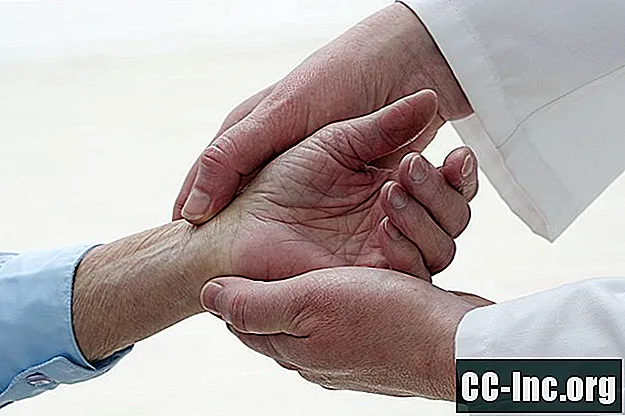 Hvordan behandle håndledd ganglion cyste