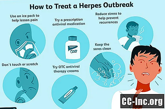 Tratamente eficiente pentru herpes