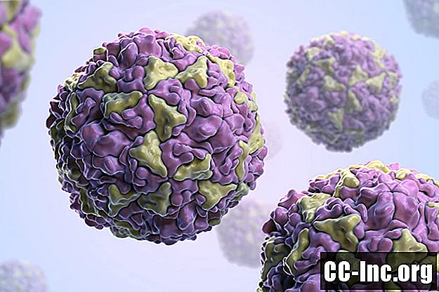Enterovirus y el posible vínculo con el síndrome de fatiga crónica