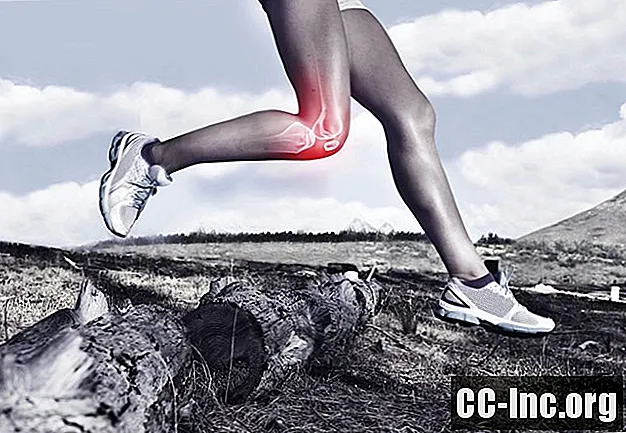 膝蓋大腿症候群の運動プログラム