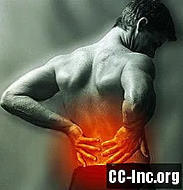 腰痛の原因としての椎間関節症