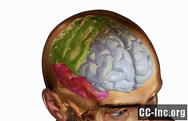 Efek dan Pengobatan Frontal Lobe Head Trauma