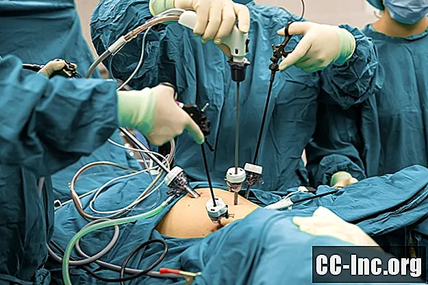 Хирургия на жлъчния мехур: Какво да очаквате в деня на операцията