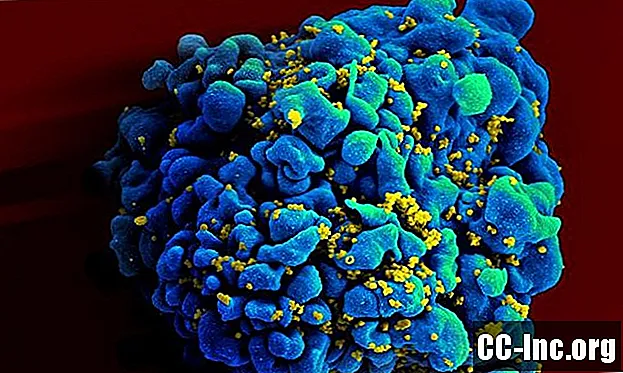 Anzeichen und Symptome einer HIV-Infektion