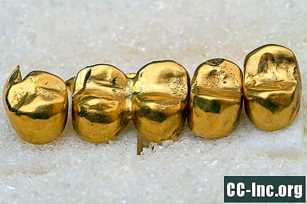 Corone dentali d'oro - Medicinale
