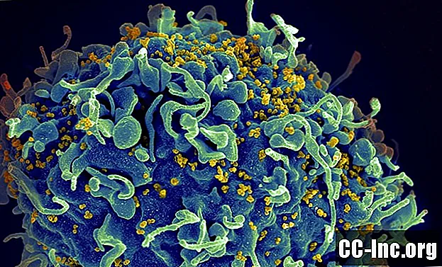 Overzicht van de HIV-2-stam
