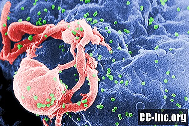 HIV ei põhjusta AIDSi sellel viisil, nagu me arvasime