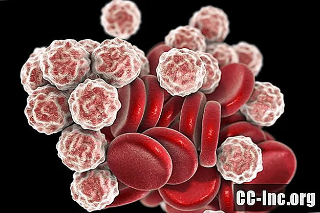 HIV un pilnīgs asins skaitlis (CBC)