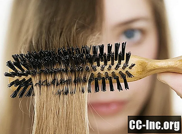 Wypadanie włosów i przerzedzenie włosów u kobiet