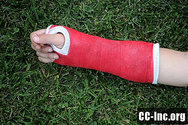 Diagnóstico y tratamiento de fracturas de mano