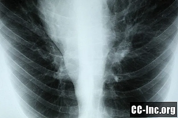 מצבים בריאותיים הקשורים ל- COPD