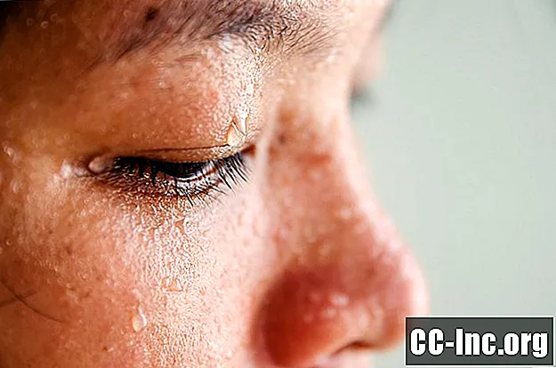 Jako znojenje kod fibromialgije i sindroma kroničnog umora