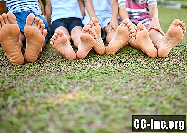 อาการปวดส้นเท้าในเด็กและวัยรุ่น