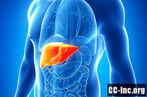 Hepatitis i akutni otkaz jetre