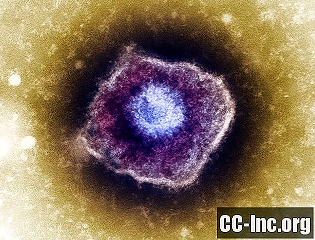 Panoramica del virus Herpes Zoster